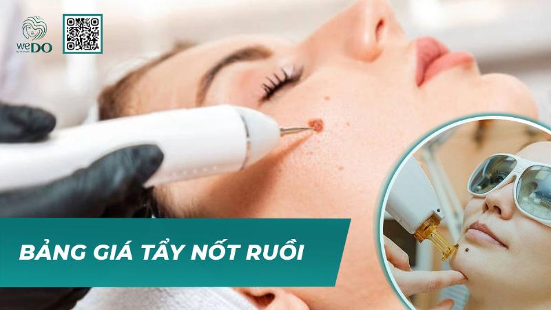 Bảng giá tẩy nốt ruồi bao nhiêu tiền và các yếu tố ảnh hưởng chi phí tại cơ sở uy tín